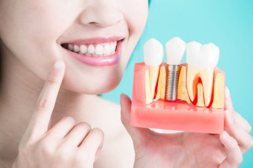 dental implant in jamshedpur