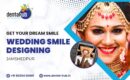 smile design