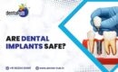 Dental Implants Jamshedpur
