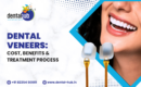 Dental Veneer in Jamshedpur