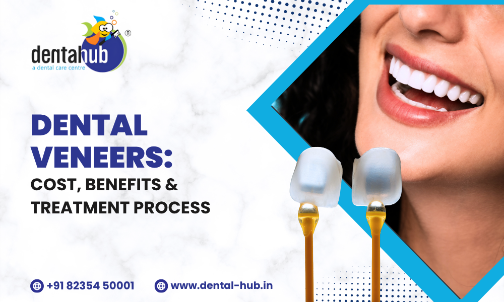 Dental Veneer in Jamshedpur