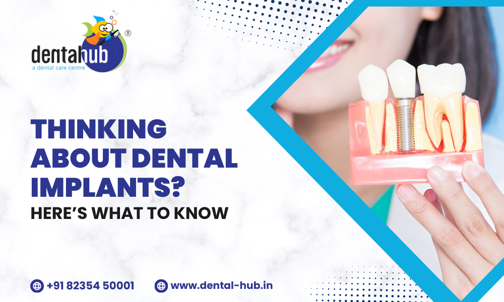 Dental Implants in Jamshedpur