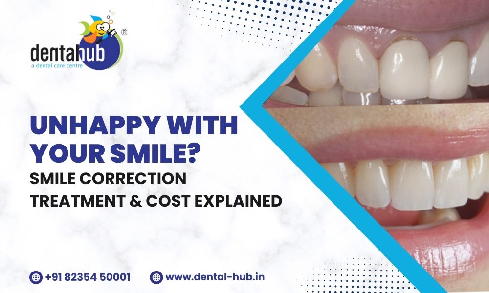 smile makeover cost in india