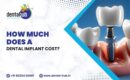 dental implant cost