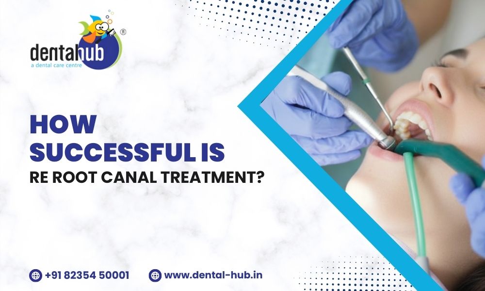 root canal treatment in jamshedpur