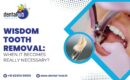 wisdom tooth removal in Jamshedpur
