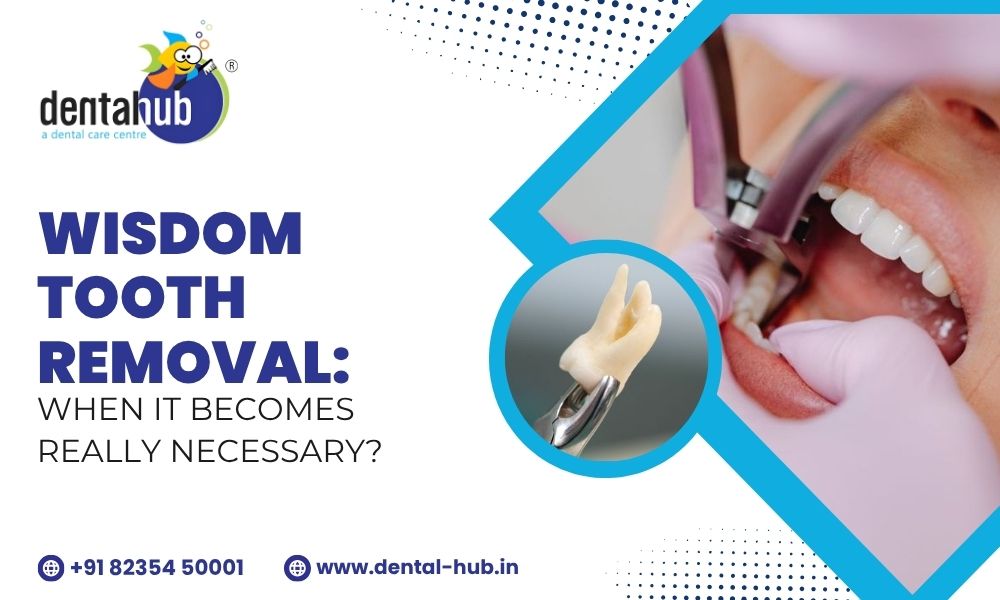 wisdom tooth removal in Jamshedpur